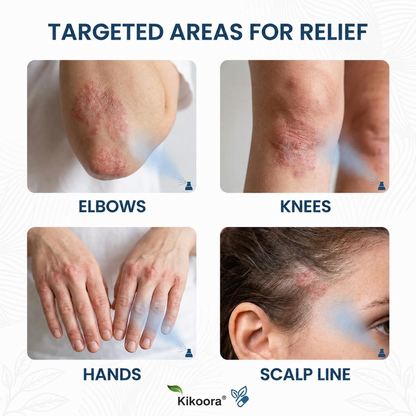 ✨Kikoora® Magnesium Botanical Spray –  Advanced Skin Recovery for Psoriasis & Eczema | Rapid Soothing, Steroid-Free