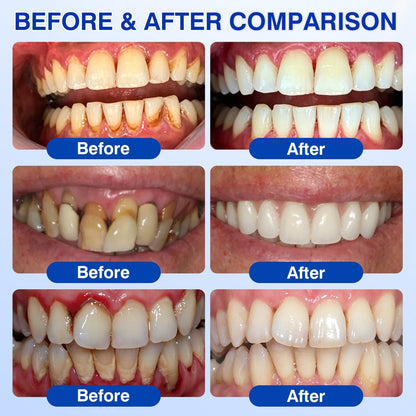 🇬🇧👨‍⚕️🦷🛡️BBOJI® GumRevive Periodontal Repair Gel