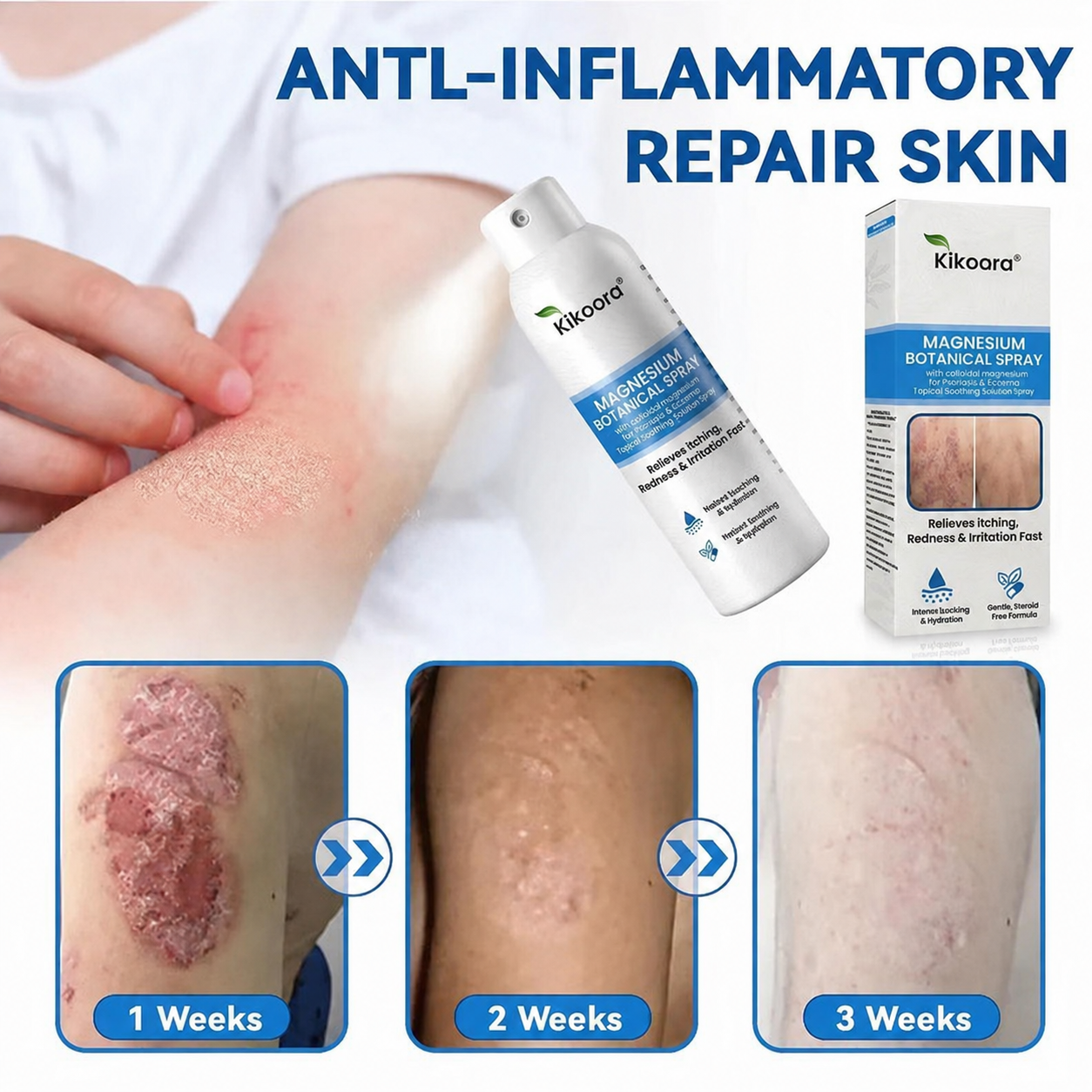 ✨Kikoora® Magnesium Botanical Spray –  Advanced Skin Recovery for Psoriasis & Eczema | Rapid Soothing, Steroid-Free