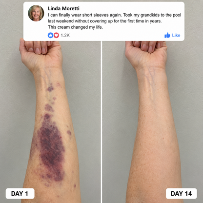 Kikoora™ Bruise Repair & Skin — Strengthening Cream
