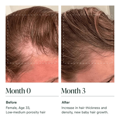 Kikoora® The Hair Multiplier