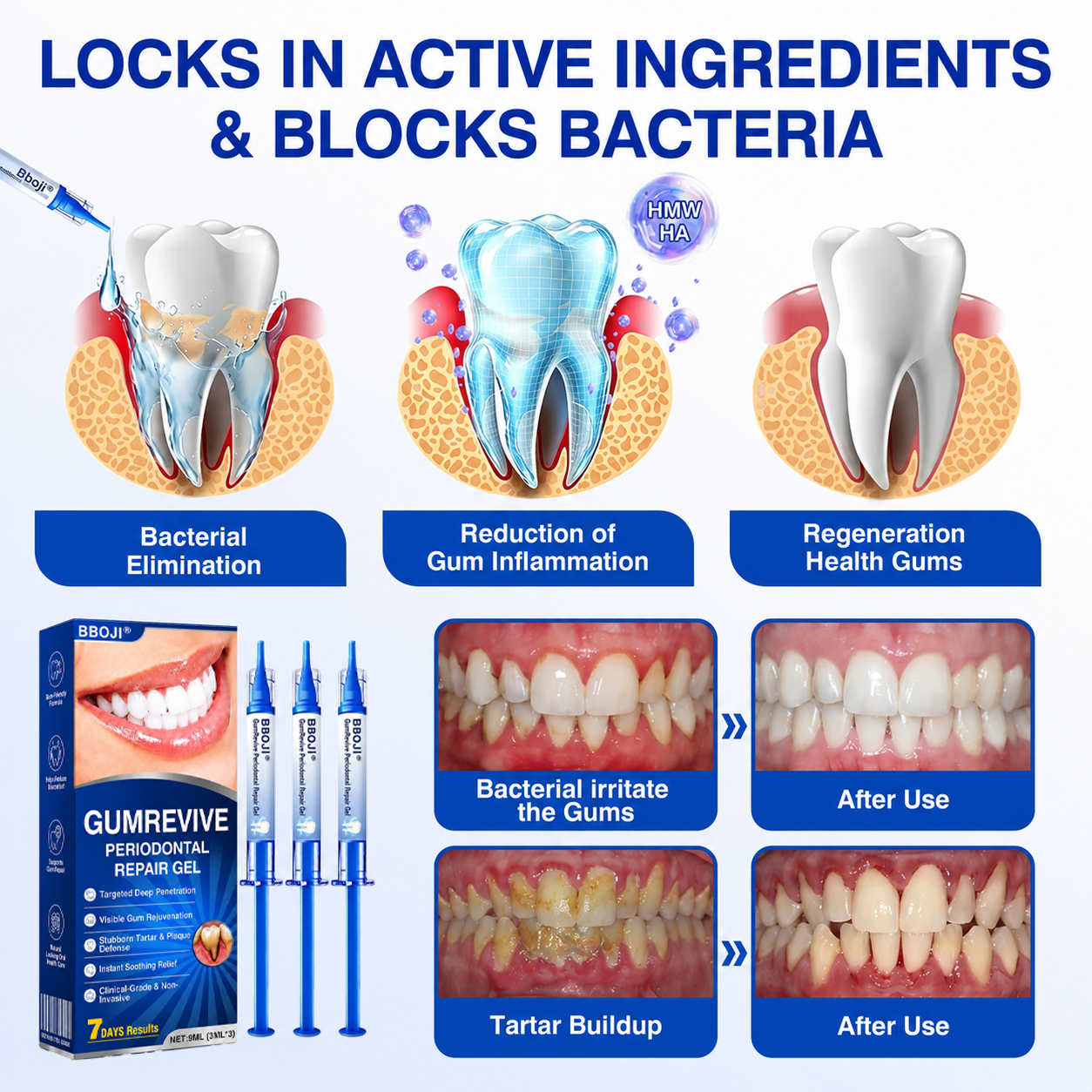 🇬🇧👨‍⚕️🦷🛡️BBOJI® GumRevive Periodontal Repair Gel