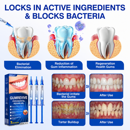 🇬🇧👨‍⚕️🦷🛡️BBOJI® GumRevive Periodontal Repair Gel
